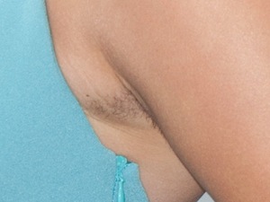 Pixie Lott hairy armpit