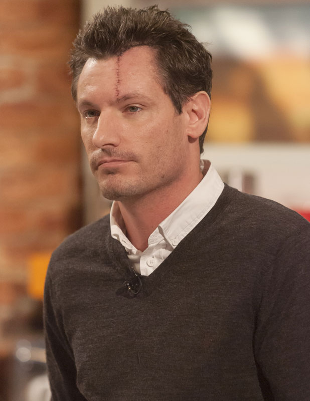 Dean Gaffney On Near Fatal Car Crash I M Very Lucky To Be Alive Celebrity News News Reveal