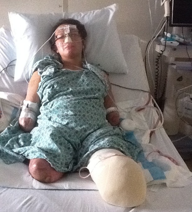 Karen was given a 10 per cent change of survival